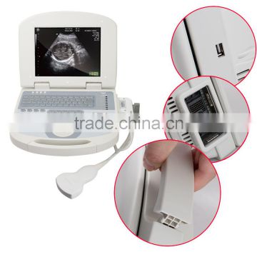 Medical Devices digital Clear Imaging portable ultrasound machine for pregnancy