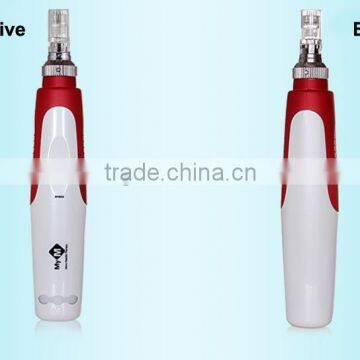 Newest Stretch Mark Removal Electric Derma Roller Pen for Scar Removal photo-6