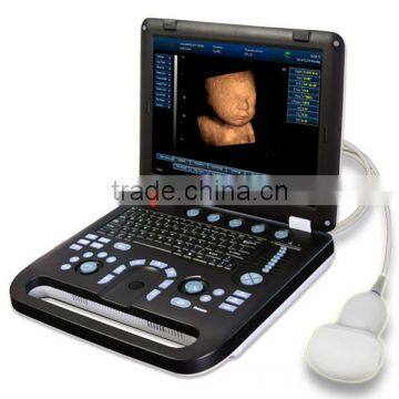 MCB-E5B 15in LCD Digital Laptop Ultrasound Scanner photo-3