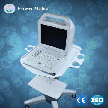 Hospital Portable Veterinary Ultrasound Scanner