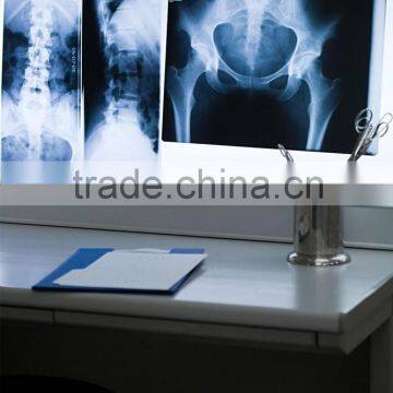 x ray industrial film viewer ,radiographic film, ct scan film for medical equipment  china