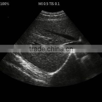 UProbe-20 Probe Type Ultrasound Scanner for Laptop photo-4