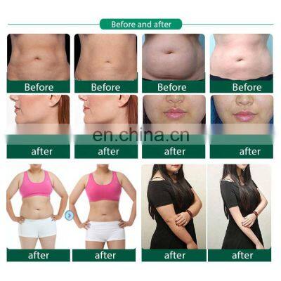 Amazon Best Selling 5 Handles Fat Loss Machine Coolsculption Fat Freezing Machine Cryolipolysis New Fat Freeze rf Cavitation photo-4