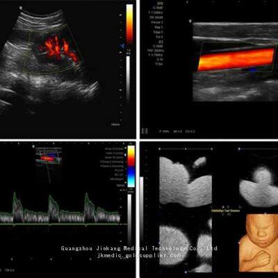 C20 Color Ultrasound Machine, Color Doppler photo-4