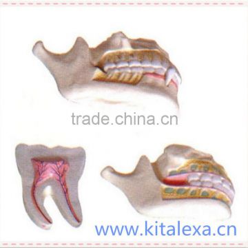 KA-TP00017 Deciduous teeth and permanent teeth dentition model