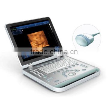 SS-10PLUS Laptop 4D Ultrasound Scanner for ob gyn