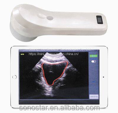 Wireless Mini Ultrasound Probe (4D Bladder Scanner)