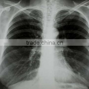 dry image films,medical x-ray film,x-ray lead glass accessories,fuji medical x-ray film