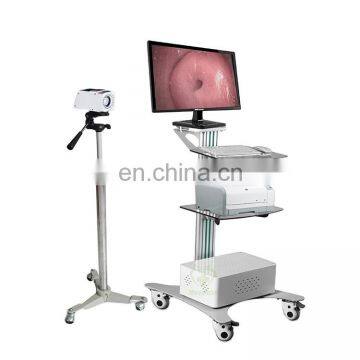 MY-F004A Medical Trolley-type Digital Electronic Colposcope for Gynecology