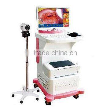Digital Video Colposcope, Laptop Video Colposcope, Gynecology Video Colposcope photo-6