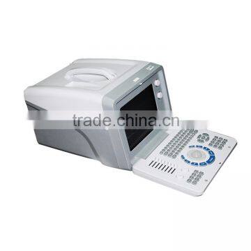 High Quality Ultrasound Machine Medical Equipment Ultrasound Machine Portable photo-4
