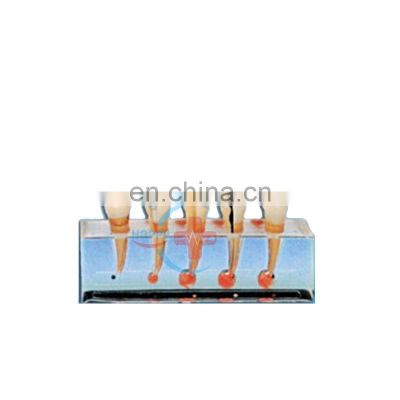 HC-S411 Endodontic treatment steps model Medical science endodontic model dental pulp disease clinical teeth teaching model