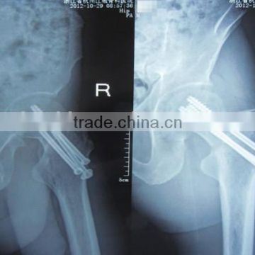 high quality three banks led medical x ray film /ce approved hot selling medical film x ray