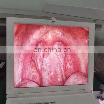 MY-P038B Medical Endoscope 17 Inch HD LCD Screen Portable Endoscopic Camera photo-3