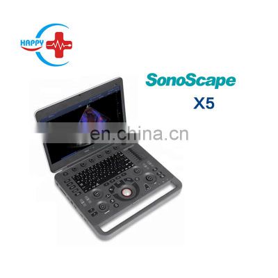 sonoscape x5 ultrasound scanner color ultrasound scan easy scanner