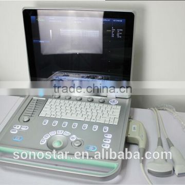 hand held doppler ultrasound scanner