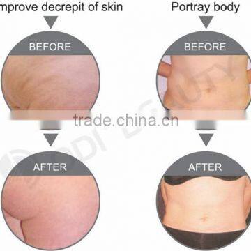 Skin Tightening Beauty Machine OD-R105 Face Lifting Portable rf Radio Frequency Facial Machine for Home Use photo-6