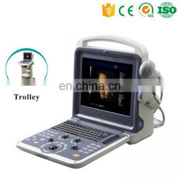 High Resolution MY-A035B medical Portable Full Digital Color Doppler Ultrasound Diagnostic System with Ultrasound probe