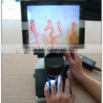 nail fold microcirculation microscope capillaroscope video microcirculation microscope capillary microscope