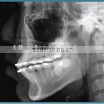 China Cheap Dental Panoramic and Cephalometric X-ray Machine photo-6