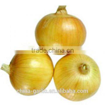 2014 New Season!!! China Different Packages Onion