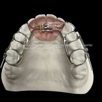 Orthodontic-Appliance China Dental Laboratory - Outsourcing Dental Lab photo-3