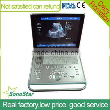 Sonostar Hot Sale High Quality Medical Portable Ultrasound Machine Best Price C5