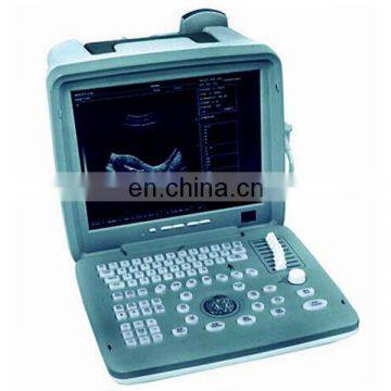 XF-400A Digital portable Ultrasound Scanner