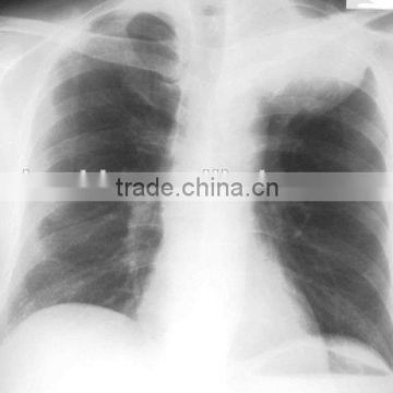 Imaging medical ray film,digital x-ray cr,fuji dry film sale from Chinese manufacturer