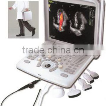 Digital laptop ultrasound