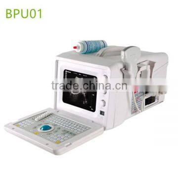 Full Digital B mode Ultrasound Diagnostic Instrument and cheap portable ultrasound machine price- BPU01