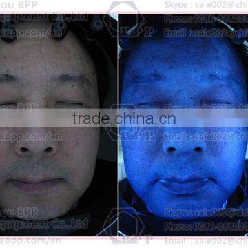 2015 Hot uv Light Facial Skin Analysis Machine for Speckles Analysis photo-2