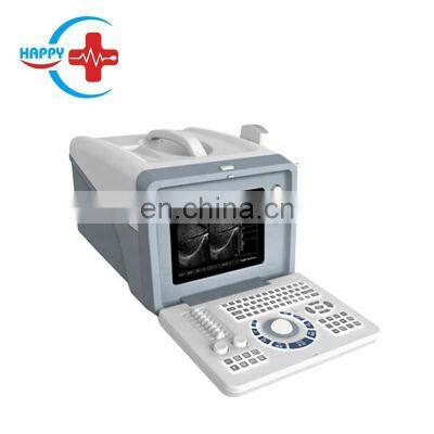 Cheap price full digital Portable ultrasound machine scanner/cheaper ultrasound machine