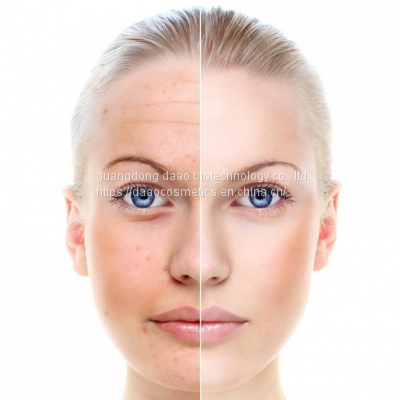 Private Label Best Natural Serum Skin Care Whitening Facial Serum Vitamin C With Hyaluronic Acid photo-3