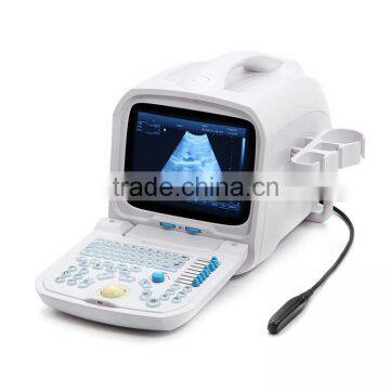 Beautiful Compact Diagnostic Ultrasound Probe / Mini Ultrasound Machine / Portable Ultrasound Scanner photo-2