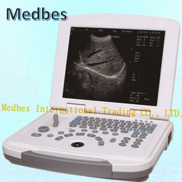 Version Full-Digital Laptop Ultrasound Scanner