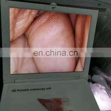 MY-P038B Medical Endoscope 17 Inch HD LCD Screen Portable Endoscopic Camera photo-4