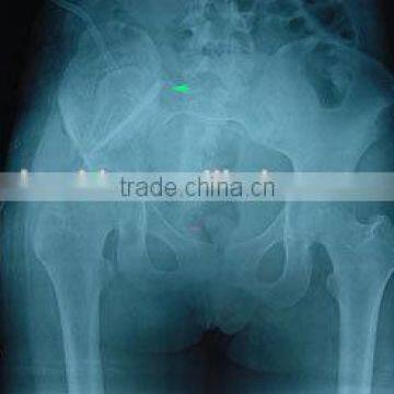 Supplying x ray film, medical dry film made in China, compatible with agfa and fuji