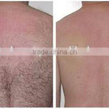 2016 Advanced Beaury Clinic Use Ipl Laser Hair Removal Machine Price