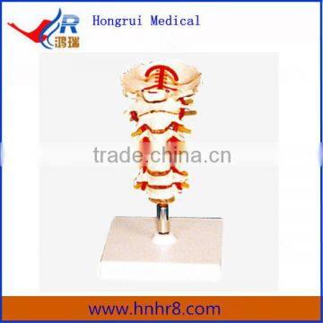 Hot Sale Lumbar Vertebra Medical Model Price