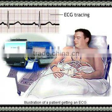 China ECG