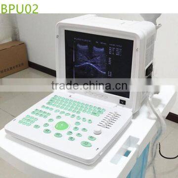 China Most popular medical portable ultrasound machine- BPU02