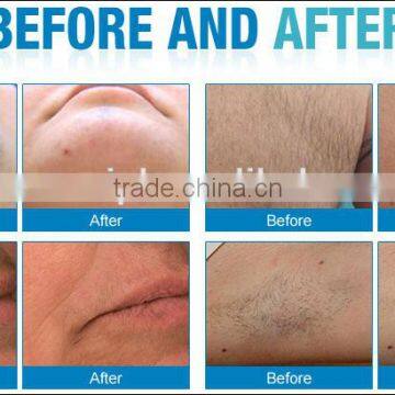 Laser Diode SL-808P With ChillTip Handpiece Provides the Ultimate in Epidermal Contact Cooling Hairy Removal Beauty Machine photo-5