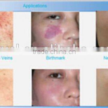 Sign in Optic Fiber 532,808,940,980nm,spider Veins Laser Treatment Machine 940nm Laser Diode photo-6