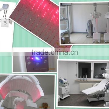 Diode laser helmet hair loss