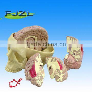 human Brain and Partial Skull model