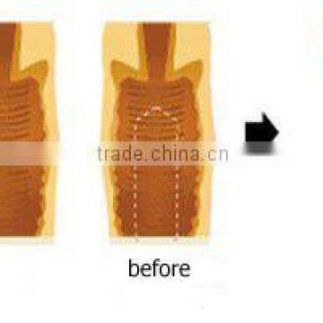 Hotting!!! Co2 Laser Medical Machine for Vaginal Tighten/vaginal Rejuvenation for Medical Use photo-6