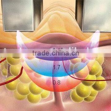 Touch Screen Viora Reaction photo-2