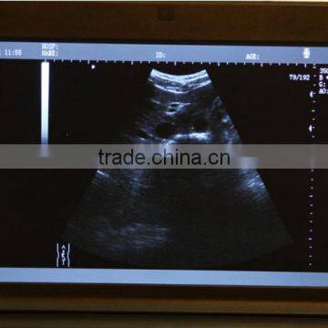 Hot Sale Black Color 10.1-inch High-resolution TFT LCD Portable pc Ultrasound Machine for Scan photo-2