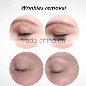 3in1 Machine Best Professional Multifunction 755nm Alexandrite Laser and Long Pulsed Laser 1064nm New Laser From Popipl photo-6